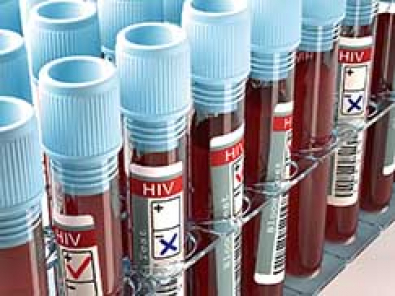 hiv.jpg
