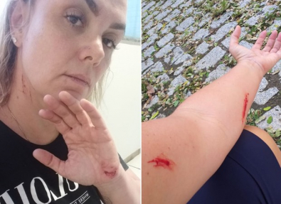 ana-paula-agressao2.jpg