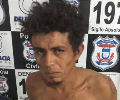 Marido arranca lábio,nariz e parte do rosto de mulher em MT