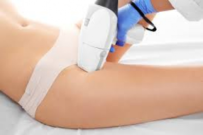 depilacaolaser.jpg
