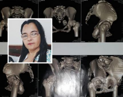 femur.jpg