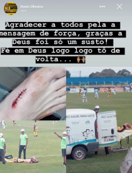JOGADOR MACHUCADO.jpeg