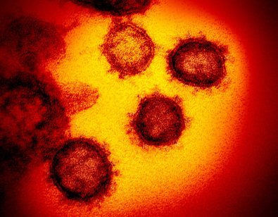 CORONAVIRUS-FOLHAMAX.jpg