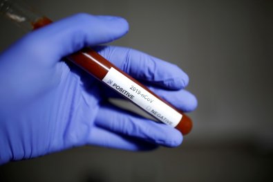 positivo-coronavirus-covid.jpg