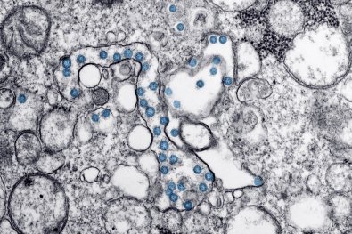 CORONAVIRUS-COVID-FOLHAMAX.jpg