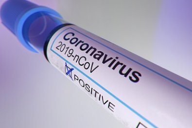 coronavirus-exame.jpg