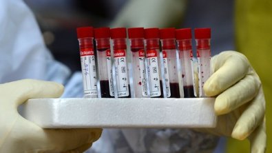 CORONAVIRUS-FOLHAMAX.jpg