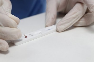 teste-rapido-novo-coronavirus-sc.jpeg
