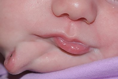 Bebï¿½-com-mï¿½-formaï¿½ï¿½o-facial.jpg