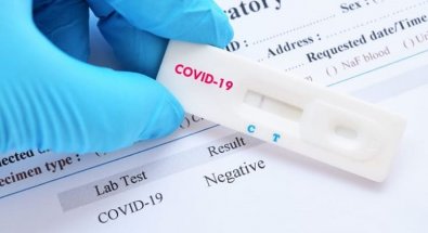 teste-rapido-coronavirus-covid19.jpg