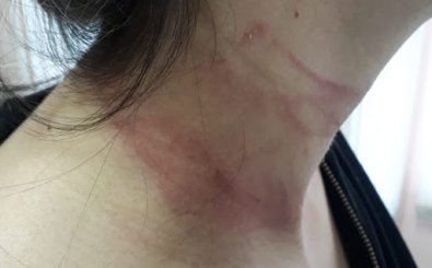 Homem tenta estuprar e enforcar mulher em bar em MT