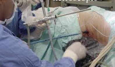 nefro-cirurgia.jpg