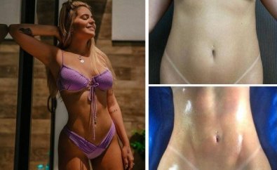 viih tube lipo.jpg