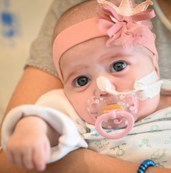 bebe transplante.jpg