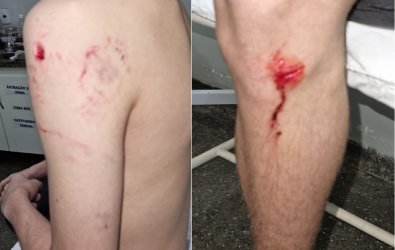 ataque cachorro.jpg