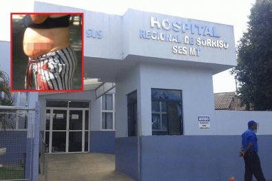 hospital regional sorriso, gravida corta barriga