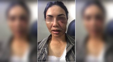 mulher espancada tangara