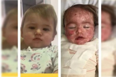 bebe alergia.JPG