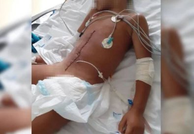 menino atropelado.JPG
