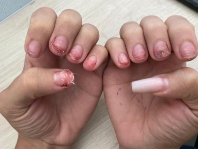 unhas ilustraï¿½ï¿½o.jpg