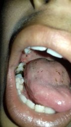 maconha-boca.jpg