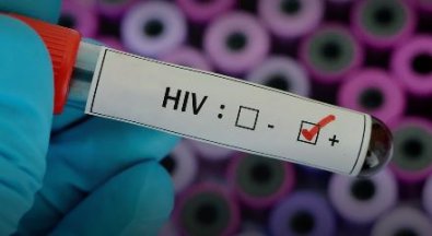 hiv-teste.JPG