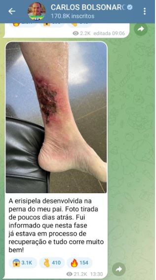 carluxa, pereba bolsonaro