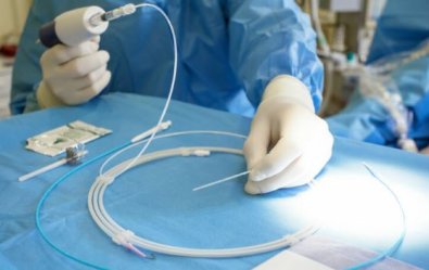cirurgia cateterismo