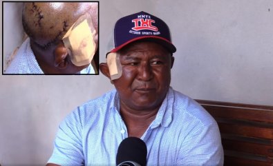 indigena atacado por onca