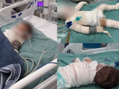 acidente grave com bebe.jpg