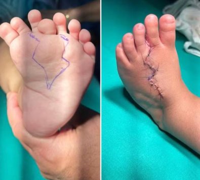 CIRURGIA Pï¿½ DUPLICADO