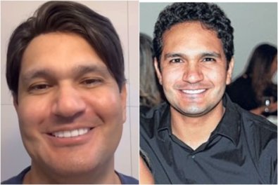 JOAO EMANUEL, ANTES E DEPOIS.jpg