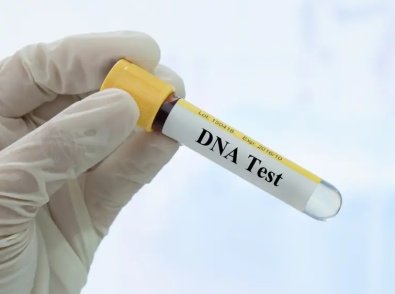 Teste Exame DNA