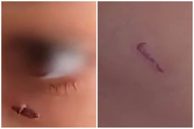 canetinha olho