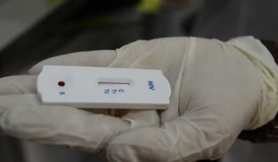 TESTE HIV.JPG