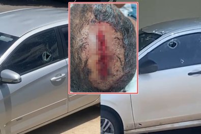 tiroteio-policial-baleado