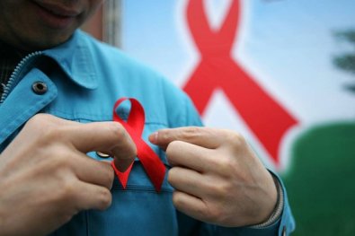 HIV-aids