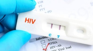 HIV.jpg