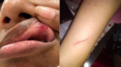 GOL-AGRESSAO.JPG