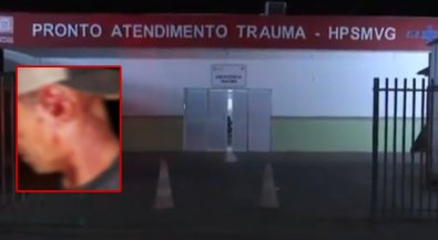 Orelha mordida