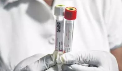 Exame-HIV
