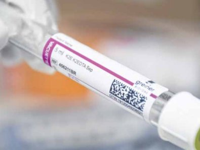 exame-HIV