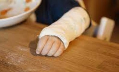 gesso-braco-crianca.jpg
