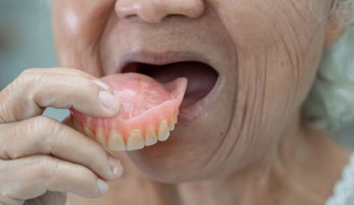 dentadura.jpg