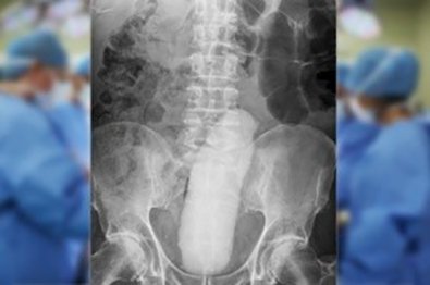 cirirugia-anus.jpg