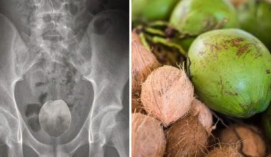 coco no anus.jpg