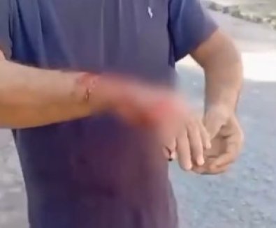 ataque pitbull.jpg