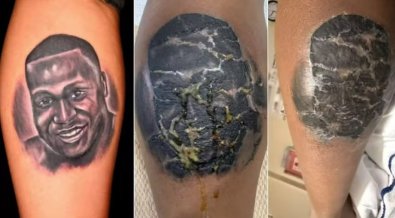 tatuagem infeccao.jpg