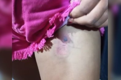 BALA DE BORRACHA.jpg
