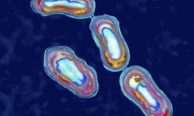 bacteria-peste.jpg